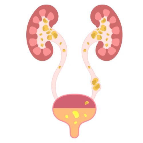 Renal transplantation Conferences