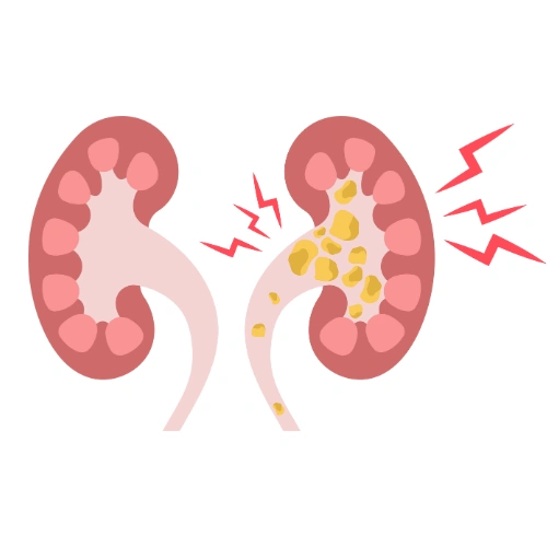 Renal transplantation Conferences