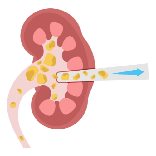 Renal transplantation Conferences