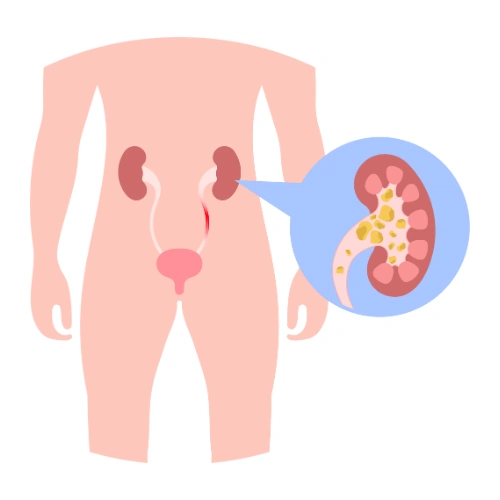 Renal transplantation Conferences