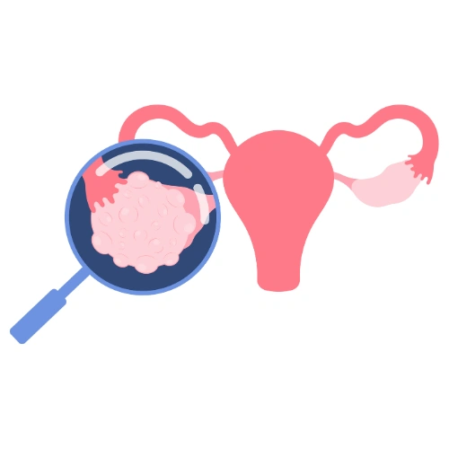 Renal transplantation Conferences